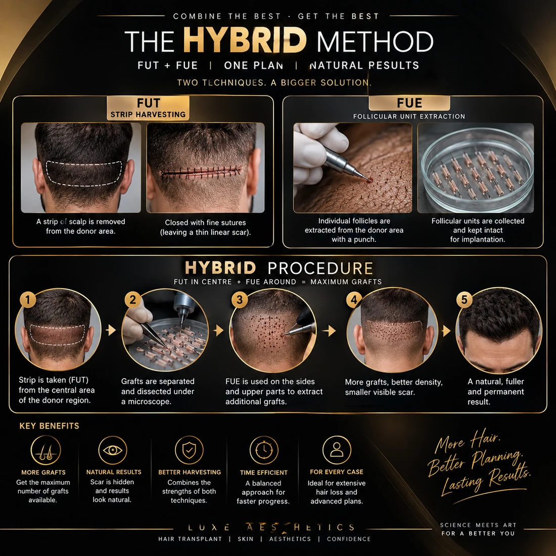 Hybrid hair transplant