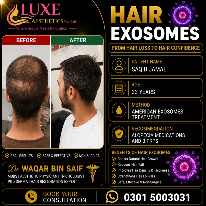 Hair transplant before and after result &mdash; Saqib Jamal at WBSK