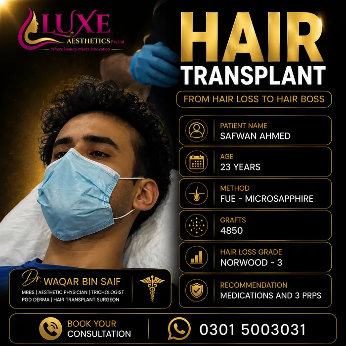 Hair transplant before and after result &mdash; Safwan Ahmed at WBSK